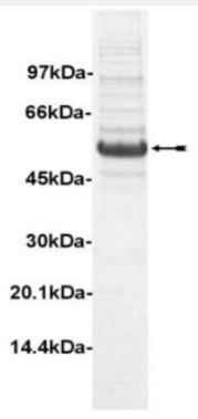 SDS-PAGE (RPS6KB1-177H).jpg